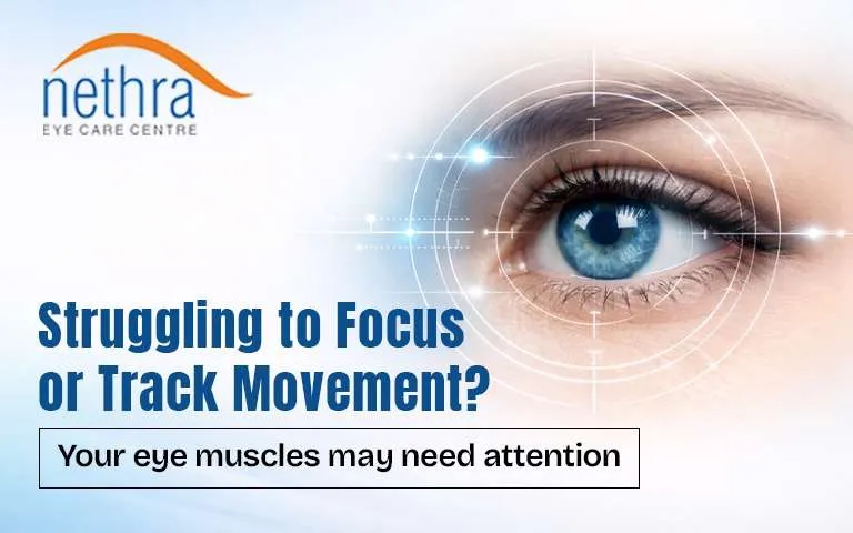 Eye Care Blogs on LASIK Cataract and Squint Treatment by Nethra Eye Care Centre